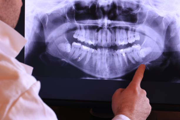 Best Weekend Emergency Dentist in Fairview Park, IN